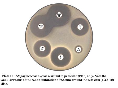 Plate 1a: Staphylococcus aureus resistant to penicillin (P0.5) only. Note the annular radius of the zone of inhibition of 9.5 mm around the cefoxitin (FOX.