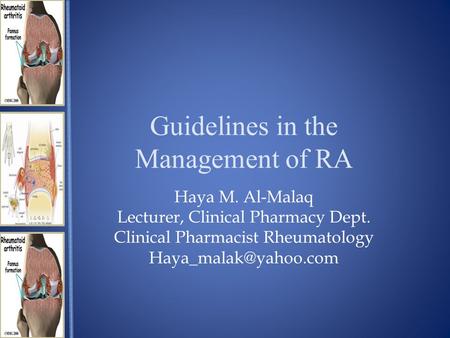 Guidelines in the Management of RA Haya M. Al-Malaq Lecturer, Clinical Pharmacy Dept. Clinical Pharmacist Rheumatology