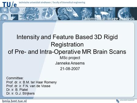 MSc project Janneke Ansems 21-08-2007 Intensity and Feature Based 3D Rigid Registration of Pre- and Intra-Operative MR Brain Scans Committee: Prof. dr.