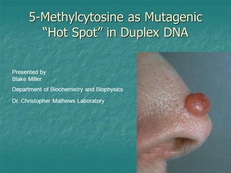 5-Methylcytosine as Mutagenic “Hot Spot” in Duplex DNA Presented by Blake Miller Department of Biochemistry and Biophysics Dr. Christopher Mathews Laboratory.