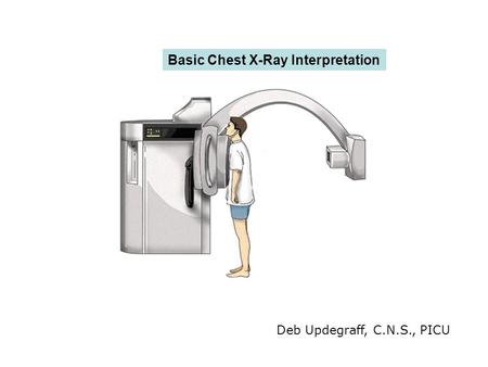 Basic Chest X-Ray Interpretation