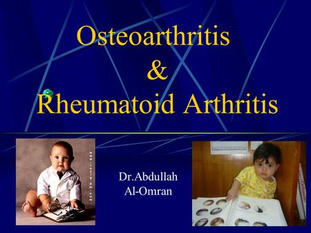Osteoarthritis & Rheumatoid Arthritis