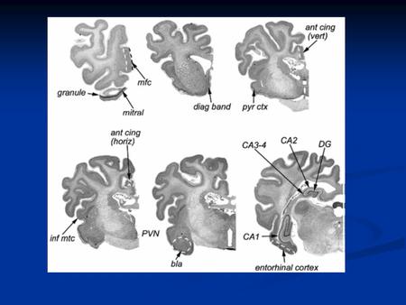 Results Animals with recognition displayed increased BDNF in the iTC, CA1 of the hippocampus, the diagonal band, basolateral amygdala and the anterior.