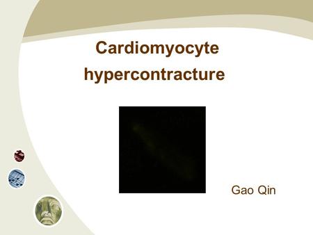 Cardiomyocyte hypercontracture Gao Qin. Background The first minutes of reperfusion repre-sent a window of opportunity for cardioprotection Development.