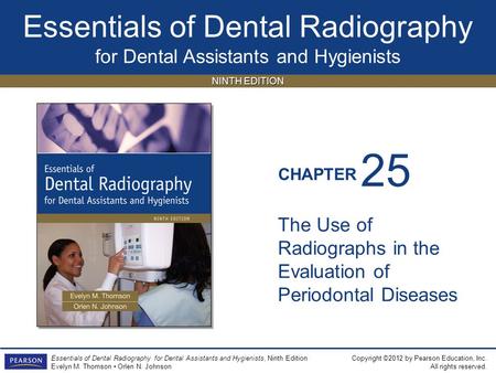 25 The Use of Radiographs in the Evaluation of Periodontal Diseases.