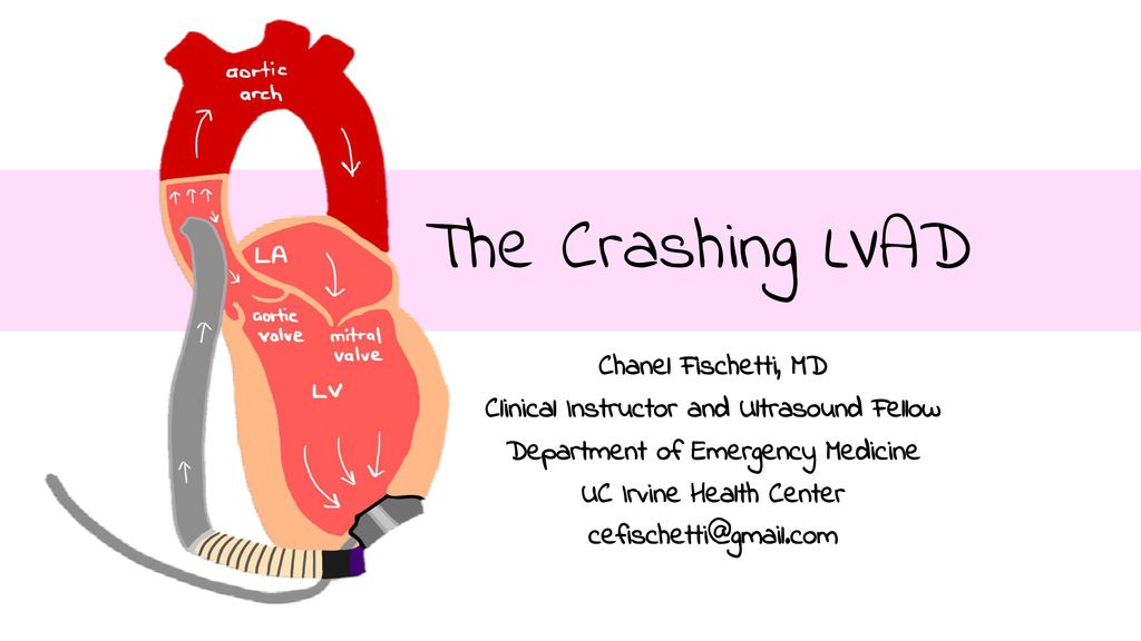 The Crashing LVAD Chanel Fischetti, MD - ppt download