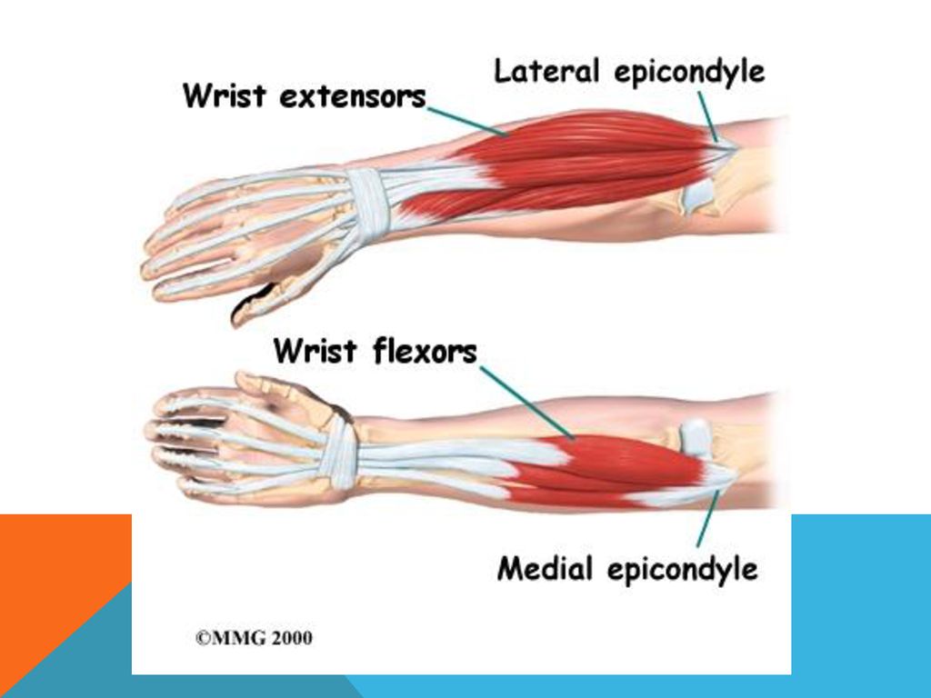 I Anatomy A. Bones * Humerus- Medial and Lateral Epicondyle, and ...