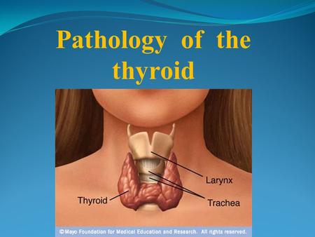 Pathology of the thyroid. Derived from pharyngeal epithelium Descends from foramen cecum to lower neck Lingual thyroid or ectopic in neck 2 lobes and.