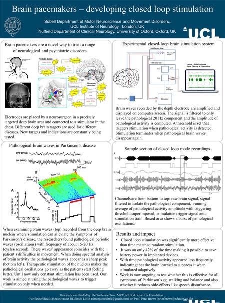 Brain pacemakers – developing closed loop stimulation Sobell Department of Motor Neuroscience and Movement Disorders, UCL Institute of Neurology, London,