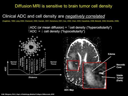 Diffusion MRI is sensitive to brain tumor cell density Clinical ADC and cell density are negatively correlated (Sugahara, 1999; Lyng, 2000; Chenevert,