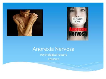 Anorexia Nervosa Psychological Factors Lesson 2.  Understand 3 treatments that are used for anorexia through presentations  Know the psychological factors.