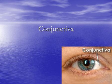 Conjunctiva. Conjunctiva It is a mucous membrane covering the inner surface of the eyelids and reflecting to cover the anterior part of the eyeball over.