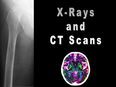 X-Rays and CT Scans.