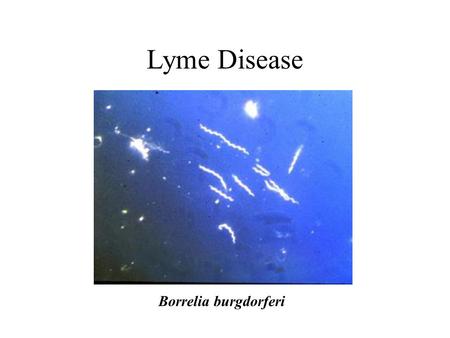 Lyme Disease Borrelia burgdorferi. Species Area Curves S = CA Z (log S) = Z (log A) + (log C) From: Gotelli, N. J. 1995. A primer of ecology. Sunderland,
