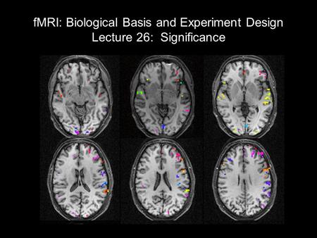FMRI: Biological Basis and Experiment Design Lecture 26: Significance Review of GLM results Baseline trends Block designs; Fourier analysis (correlation)