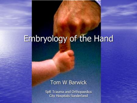 Embryology of the Hand Tom W Barwick SpR Trauma and Orthopaedics City Hospitals Sunderland.