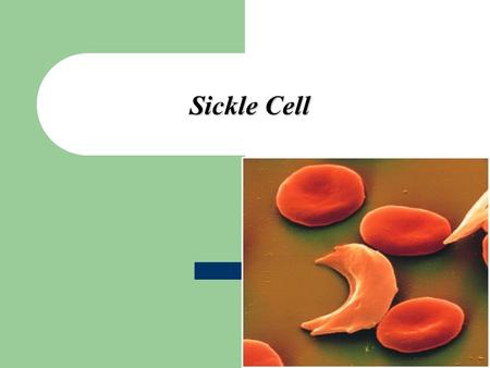 Sickle Cell Mohammed laqqan.