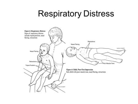 Respiratory Distress. Pediatric Respiratory System Large head, small mandible, small neck Large, posteriorly- placed tongue High glottic opening Small.