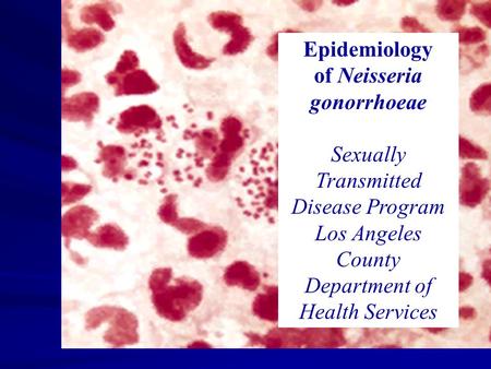 Epidemiology of Neisseria gonorrhoeae Sexually Transmitted Disease Program Los Angeles County Department of Health Services.