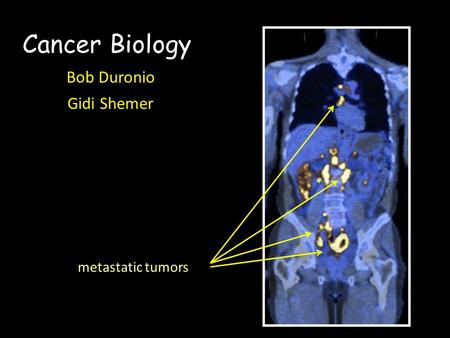 Cancer Biology Bob Duronio Gidi Shemer metastatic tumors
