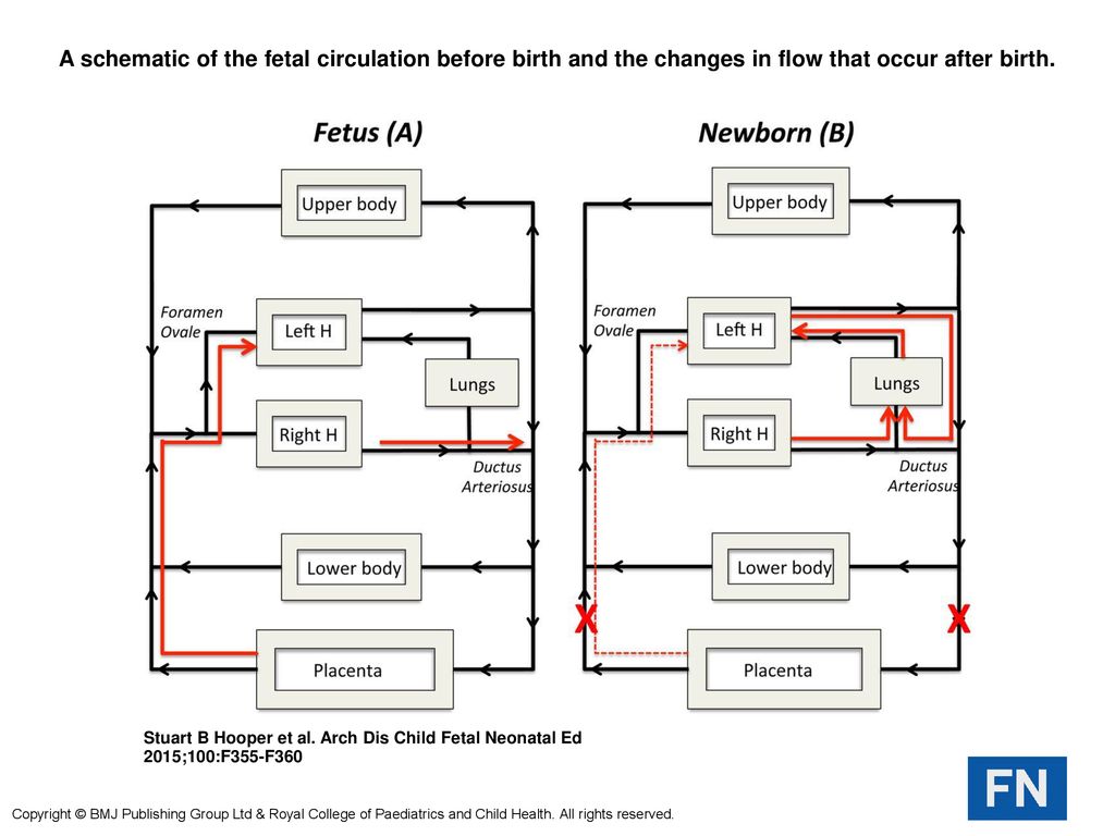 Fetal circulation flow chart