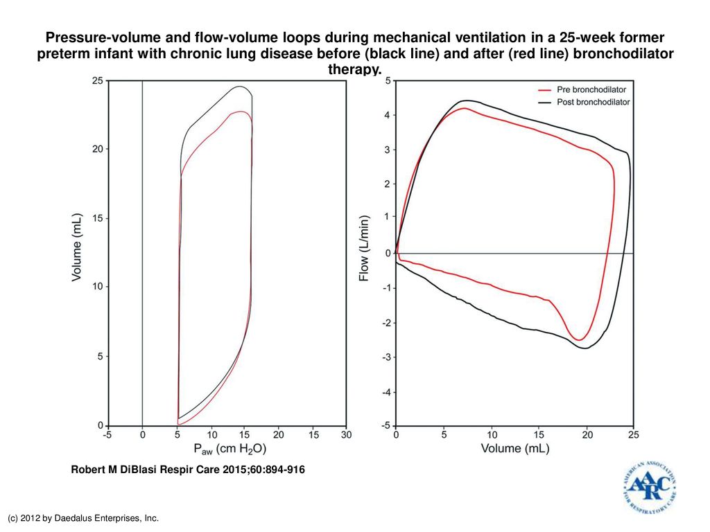 Pressure-volume and flow-volume loops during mechanical ventilation in a  25-week former preterm infant with chronic lung disease before (black line)  and. - ppt download