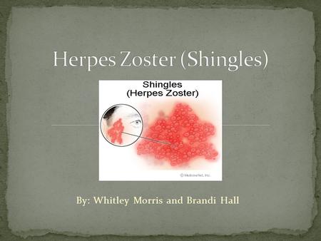 By: Whitley Morris and Brandi Hall. If so, contact your doctor immediately. You may have herpes zoster. Also known as shingles.