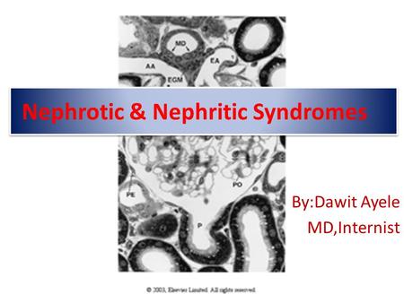 Nephrotic & Nephritic Syndromes By:Dawit Ayele MD,Internist.