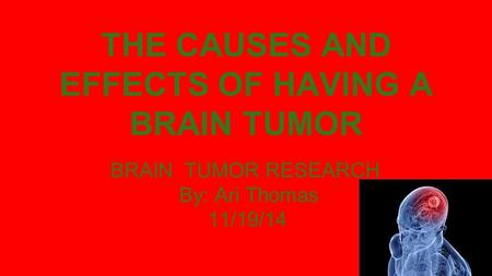 THE CAUSES AND EFFECTS OF HAVING A BRAIN TUMOR BRAIN TUMOR RESEARCH By: Ari Thomas 11/19/14.