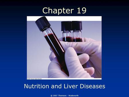 © 2007 Thomson - Wadsworth Chapter 19 Nutrition and Liver Diseases.