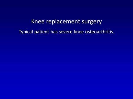 Knee replacement surgery Typical patient has severe knee osteoarthritis.