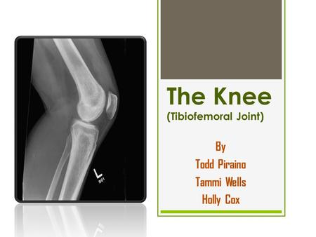 The Knee (Tibiofemoral Joint)