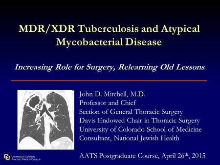 MDR/XDR Tuberculosis and Atypical Mycobacterial Disease MDR/XDR Tuberculosis and Atypical Mycobacterial Disease Increasing Role for Surgery, Relearning.