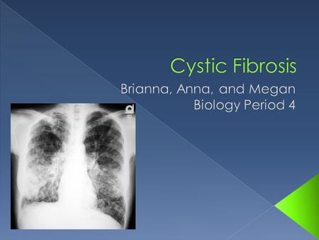 The first known definition of Cystic Fibrosis was written in 1938 by Dr. Dorothy Anderson, a pathologist in the New York Babies Hospital.  In the 17.