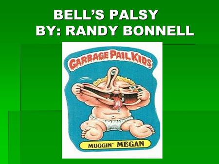 BELL’S PALSY BY: RANDY BONNELL BELL’S PALSY BY: RANDY BONNELL.
