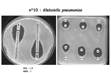 n°10 : Klebsiella pneumoniae