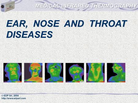 © EDP Srl, 2004  EAR, NOSE AND THROAT DISEASES.