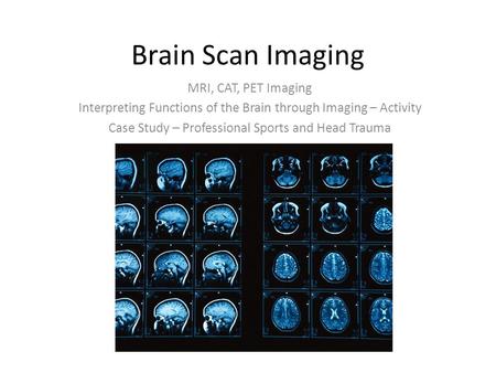Brain Scan Imaging MRI, CAT, PET Imaging Interpreting Functions of the Brain through Imaging – Activity Case Study – Professional Sports and Head Trauma.