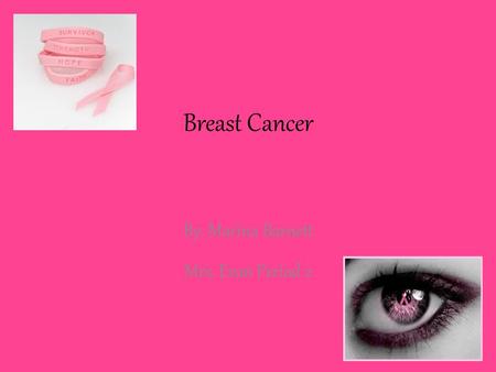Breast Cancer By: Marina Barnett Mrs. Evan Period 2.