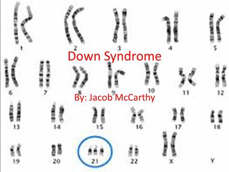 Down Syndrome By: Jacob McCarthy. Myths/truths/facts Myth: down syndrome can never be cured. Truth: research on down syndrome is making great strides.