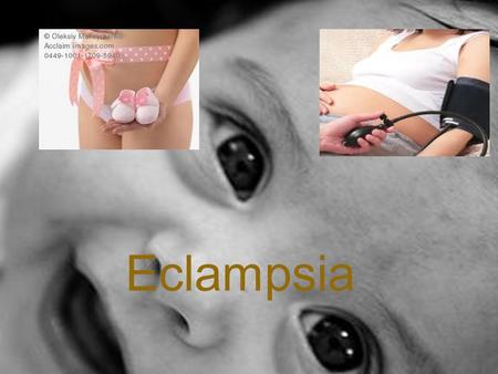 Eclampsia.