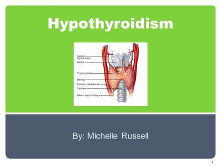 Hypothyroidism By: Michelle Russell 1. Objectives o To understand hypothyroidism and how it effects the body Causes Signs/ symptoms o Become familiar.