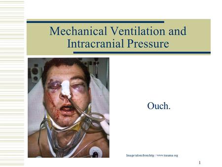 1 Mechanical Ventilation and Intracranial Pressure Ouch. Image taken from