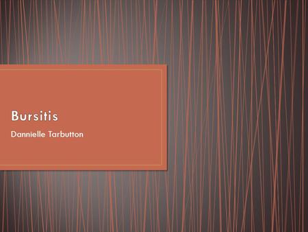 Dannielle Tarbutton. Bursitis in an inflammation or irritation of the bursa caused by repetitive motion injuries in the soft tissue on the outside of.