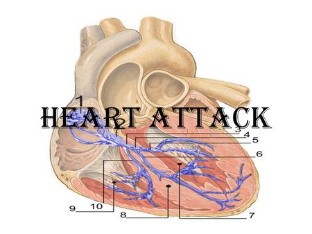 HEART ATTACK. DEFINITION The death of the cells in the area of the heart muscle where blood flow is obstructed can lead to heart attack. FACTS - approximately.