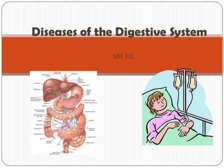 SBI 3U Diseases of the Digestive System. What is a digestive tract disease? Every now and then you may feel discomfort in the digestive tract caused by.