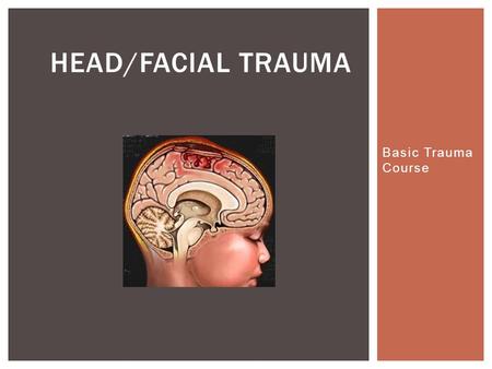 Basic Trauma Course HEAD/FACIAL TRAUMA.  Head injuries are most often caused by Motor Vehicle Crashes (MVC), especially in teens and young adults. 