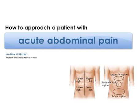 acute abdominal pain How to approach a patient with Andrew McGovern