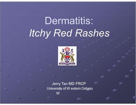 Dermatitis: Itchy Red Rashes Jerry Tan MD FRCP University of W estern Ontario W.