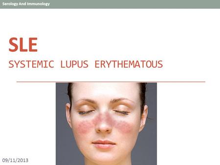 SLE Systemic Lupus Erythematous